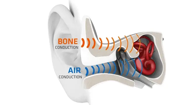Bone Conduction: Cara Kerja, Jenis, Kelebihan, Kekurangan, dan Masa Depannya